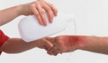 Sơ cứu bỏng lửa, nước sôi