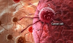 Góc nhìn mới về nguyên nhân gây ra bệnh ung thư.