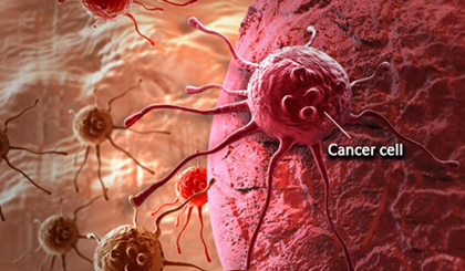 (Nguồn: MedicineNet)