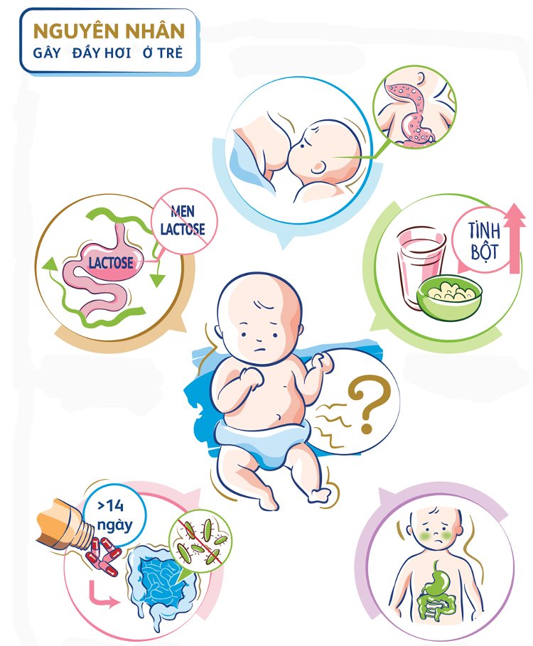 Đầy hơi ở trẻ có nhiều lí do: có thể do trẻ không hấp thu được lactose, hoặc ăn quá nhiều tinh bột...